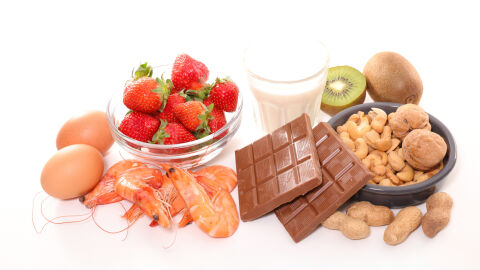 Alimentos Alimentos
