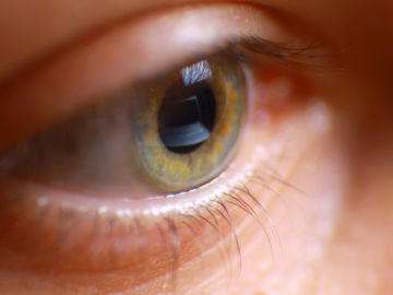 Cada vez hay más jóvenes miopes Cada vez hay más jóvenes miopes