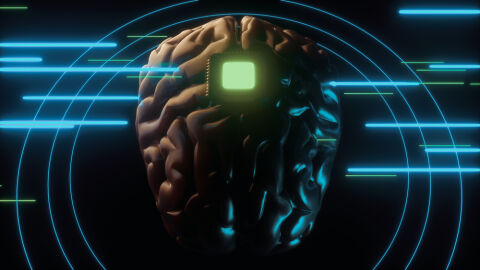'Neuroderechos'