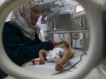 Un bebé palestino recibe tratamiento en un hospital de la Franja de Gaza.