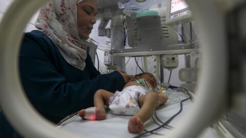 Un bebé palestino recibe tratamiento en un hospital de la Franja de Gaza.