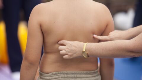 Investigaci&oacute;n de la influencia gen&eacute;tica en la obesidad infantil 