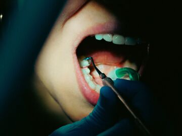 La verdad sobre los sérums dentales: lo que puede (y no puede) hacer la nueva moda para blanquear los dientes La verdad sobre los sérums dentales: lo que puede (y no puede) hacer la nueva moda para blanquear los dientes