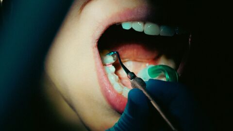 La verdad sobre los sérums dentales: lo que puede (y no puede) hacer la nueva moda para blanquear los dientes La verdad sobre los sérums dentales: lo que puede (y no puede) hacer la nueva moda para blanquear los dientes